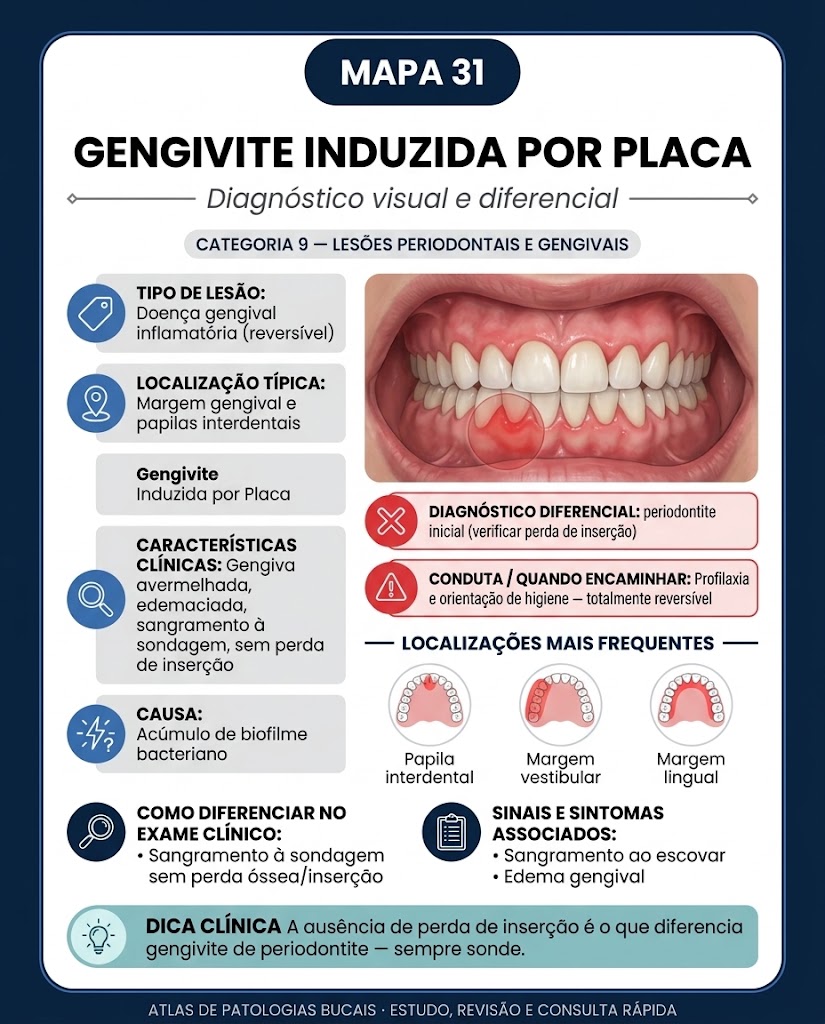 Mapa 31: Gengivite Induzida por Placa
